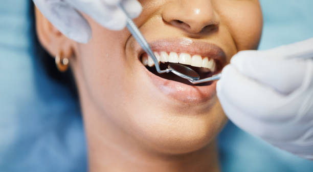 Best Emergency Dentist for Knocked-Out Tooth in Saticoy, CA